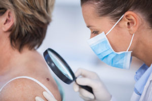 The Growing Threat of Skin Cancer